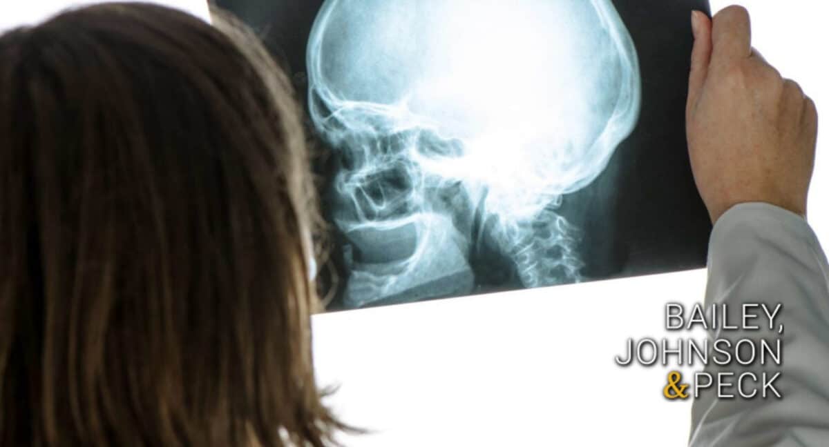 How can a skull fracture harm you